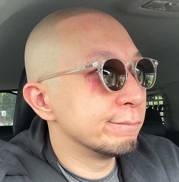 大J 近日就分享自己勤力練習的近況,眼角甚至訓練得紅腫,被網民大讚認真備賽