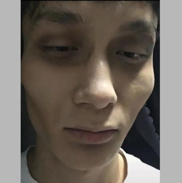 內地大學就興起一款叫「虛弱妝」的妝容