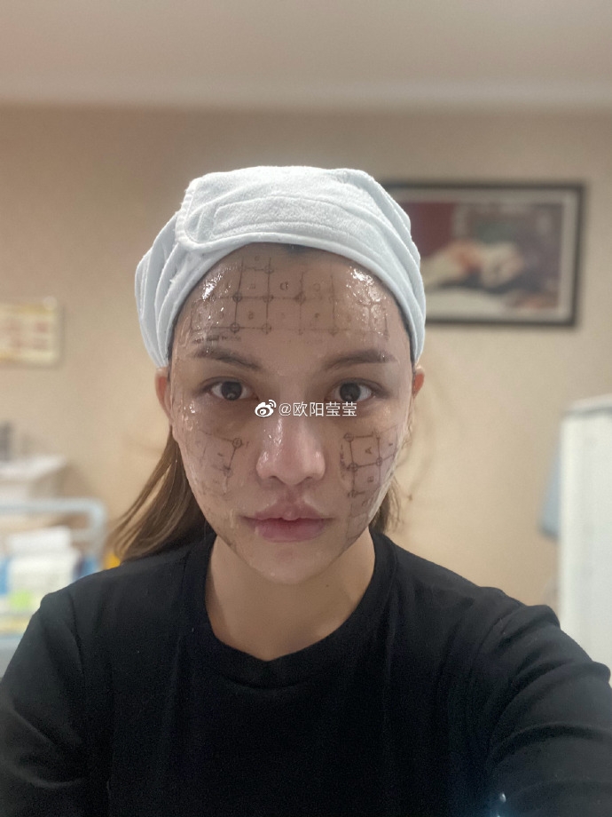 每次手術過後,歐陽瑩瑩都要花一段長時間恢復,為免家人擔心,她甚少回家!
