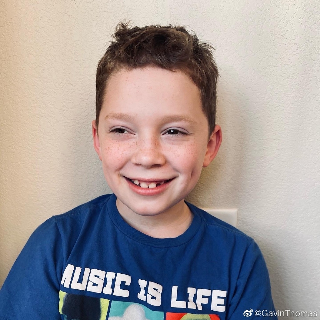 更有不少網民發現,Gavin雖然只有11歲,不過眼底下的眼紋卻比同齡孩子來得更嚴重,甚至比成年人更明顯,質疑這是因為Gavin小時候因「假笑」過度而留下的後遺症!