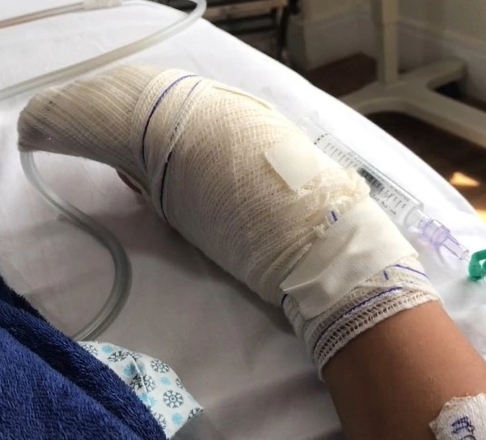 目前,Jenneffer已經接受了兩次切除手術,預料還要進行第三次手術