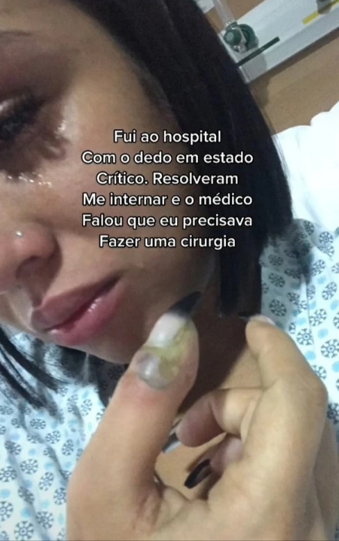 她的姆指開始持續滲出濃液,並慢慢發黑,抵受不住劇烈痛楚的Jenneffer再次回到醫院求診!