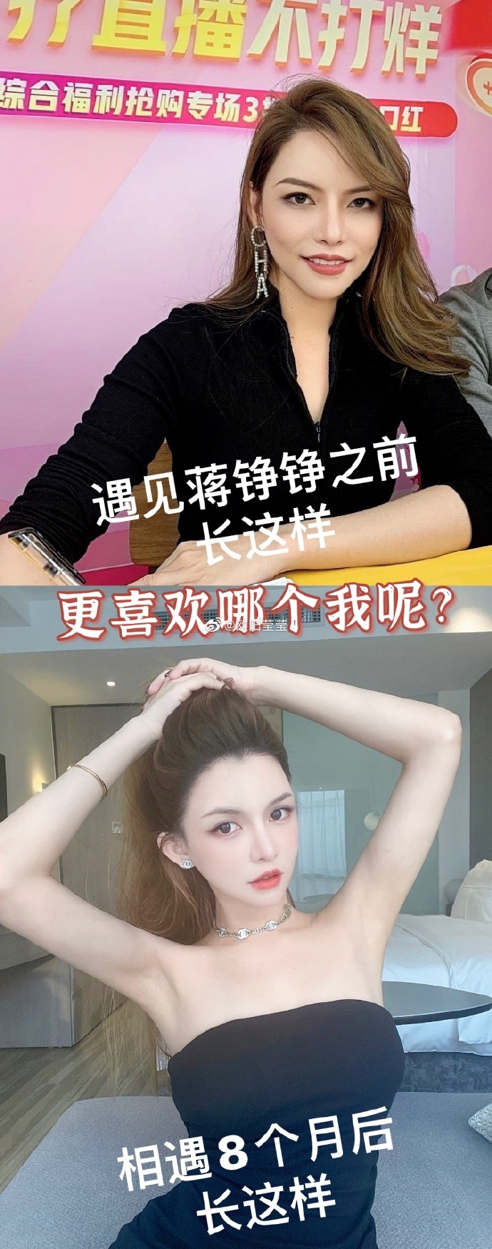 整容經驗豐富的歐陽瑩瑩分享她人生中最大型的一次手術經歷