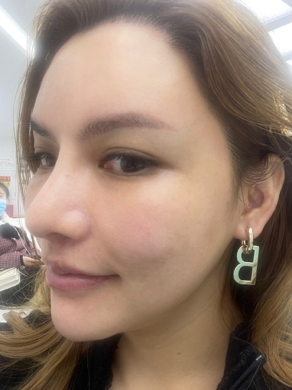 自小不愉快的經歷令她立志作出改變:「我長大以後,第一件事是要變美。」