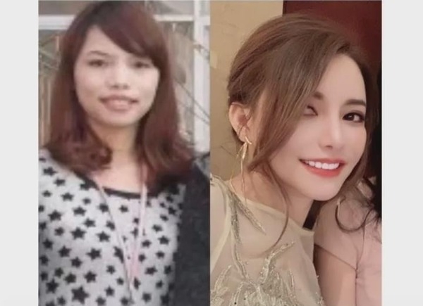 她看着醫院的整容廣告,又發現從手術室走出來的女生都變得更漂亮