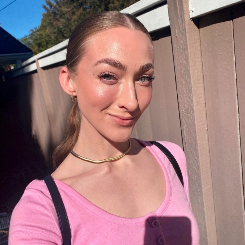 雖然Jordyn幸運地沒有因此喪失視力,但右眼卻出現不少後遺症!