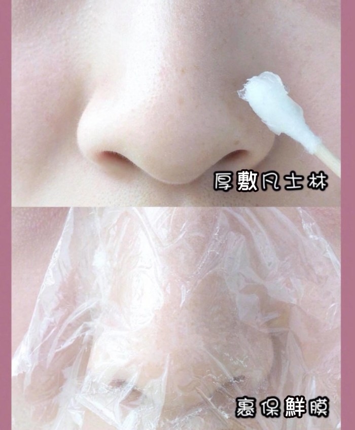 想徹底清黑頭粉刺,一定要用足夠的凡士林確保厚敷才能發揮最好功效