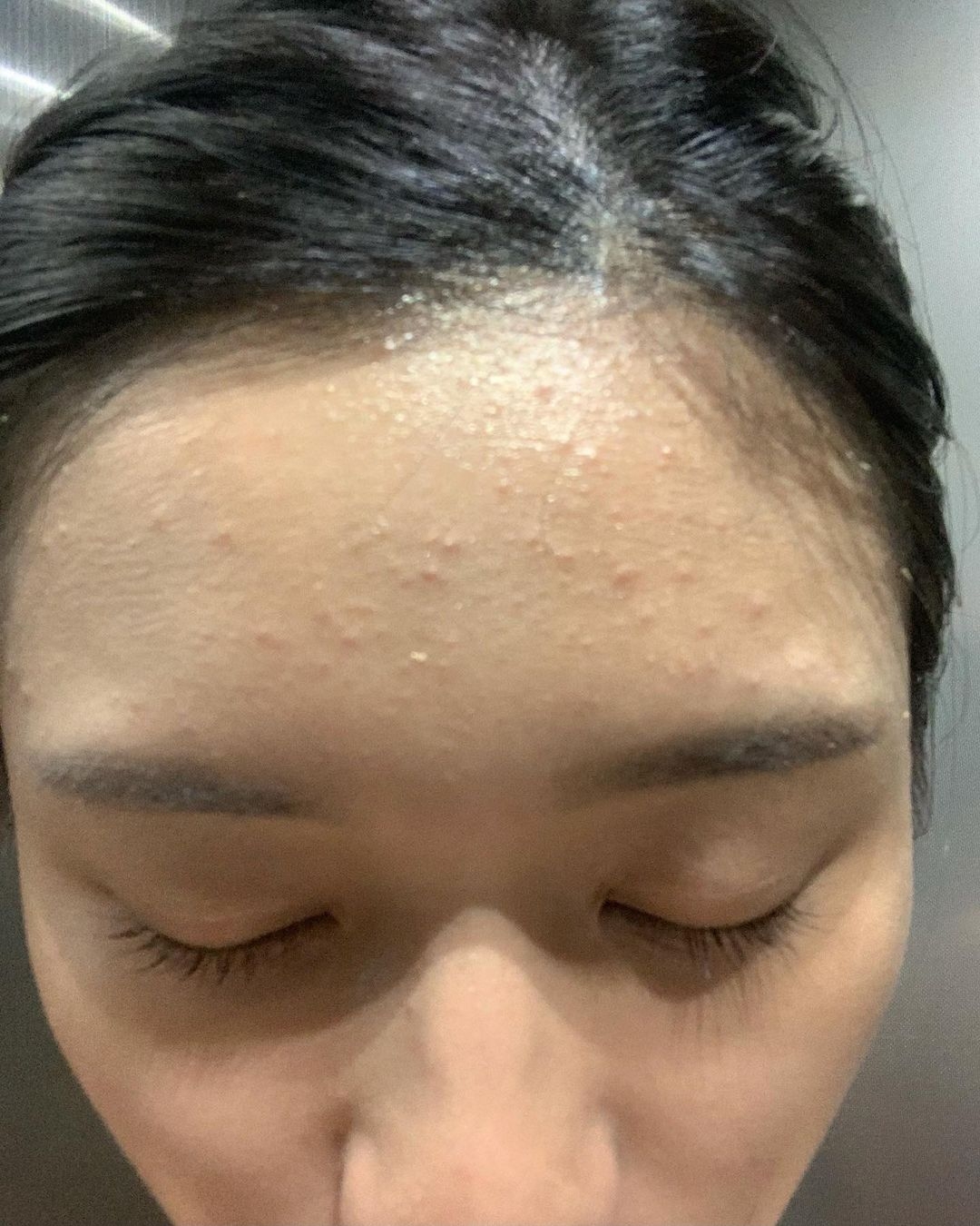 秋雯更發現，自己的皮膚已經愈來愈少有好的狀態，狀態差的時候更不能進行任何拍：攝：「不能好好工作，變成了廢人！