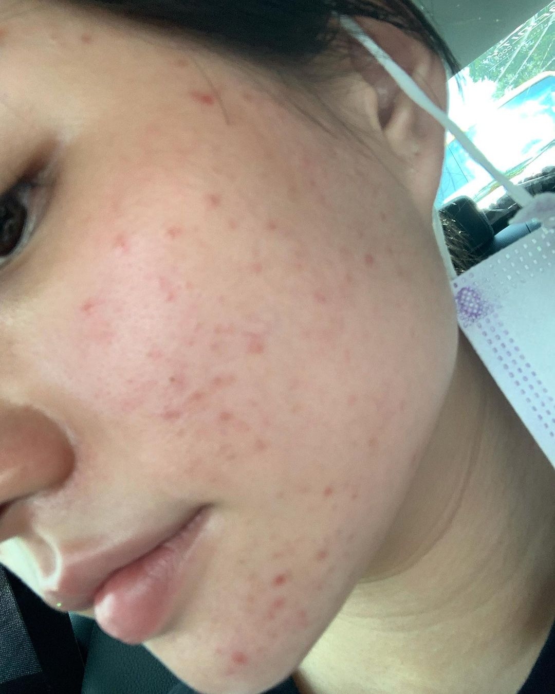 秋雯更自認自己並不是天生麗質的女孩子：「我有發過我小時候的照片，醜醜的，所以在變美這條路上我花了很多功夫！」