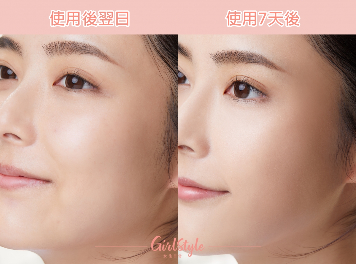 使用後翌日(左);使用7天後(右)