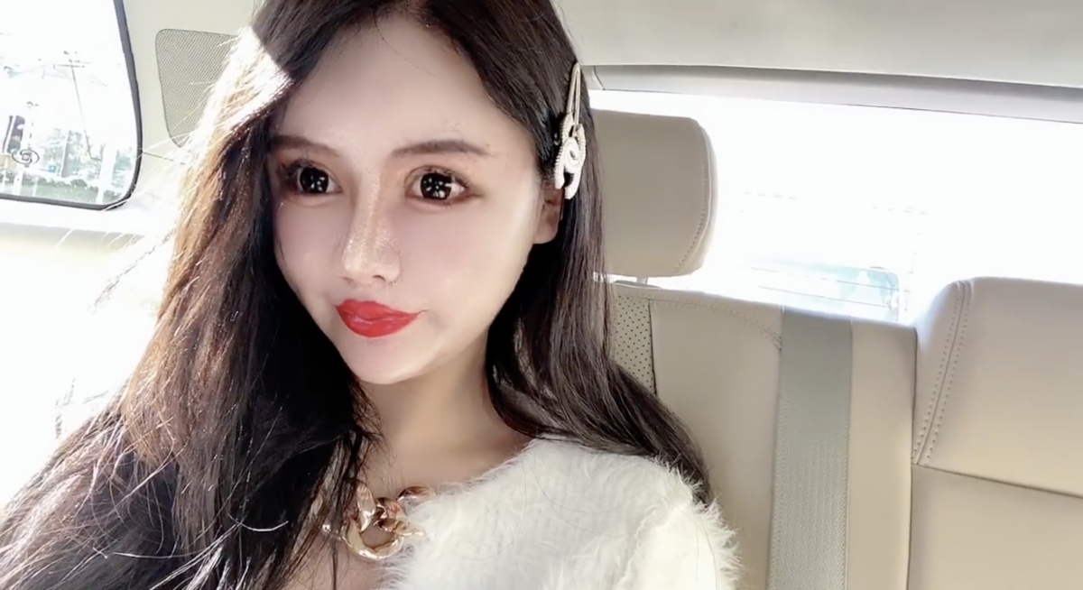 她亦曾透露因為整容出現不少後遺症,例如留下永久疤痕、眼角膜變得脆弱等!