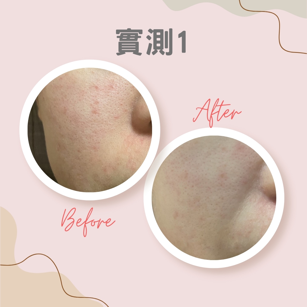 實測1：舒敏＋收毛孔效果理想