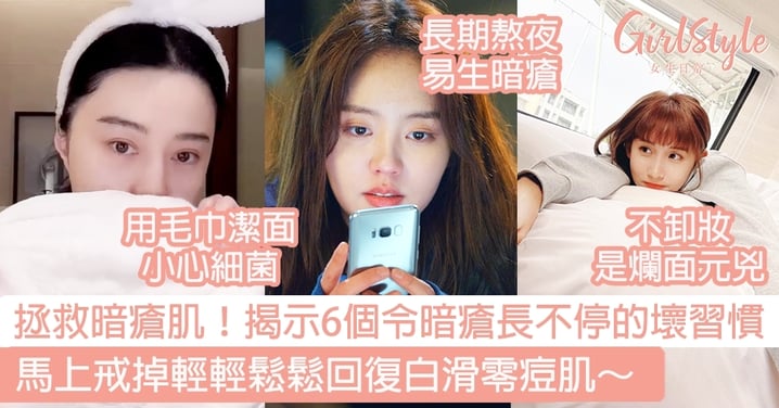 拯救暗瘡肌!揭示6個令暗瘡長不停的壞習慣,馬上戒掉輕輕鬆鬆回復白滑零痘肌~