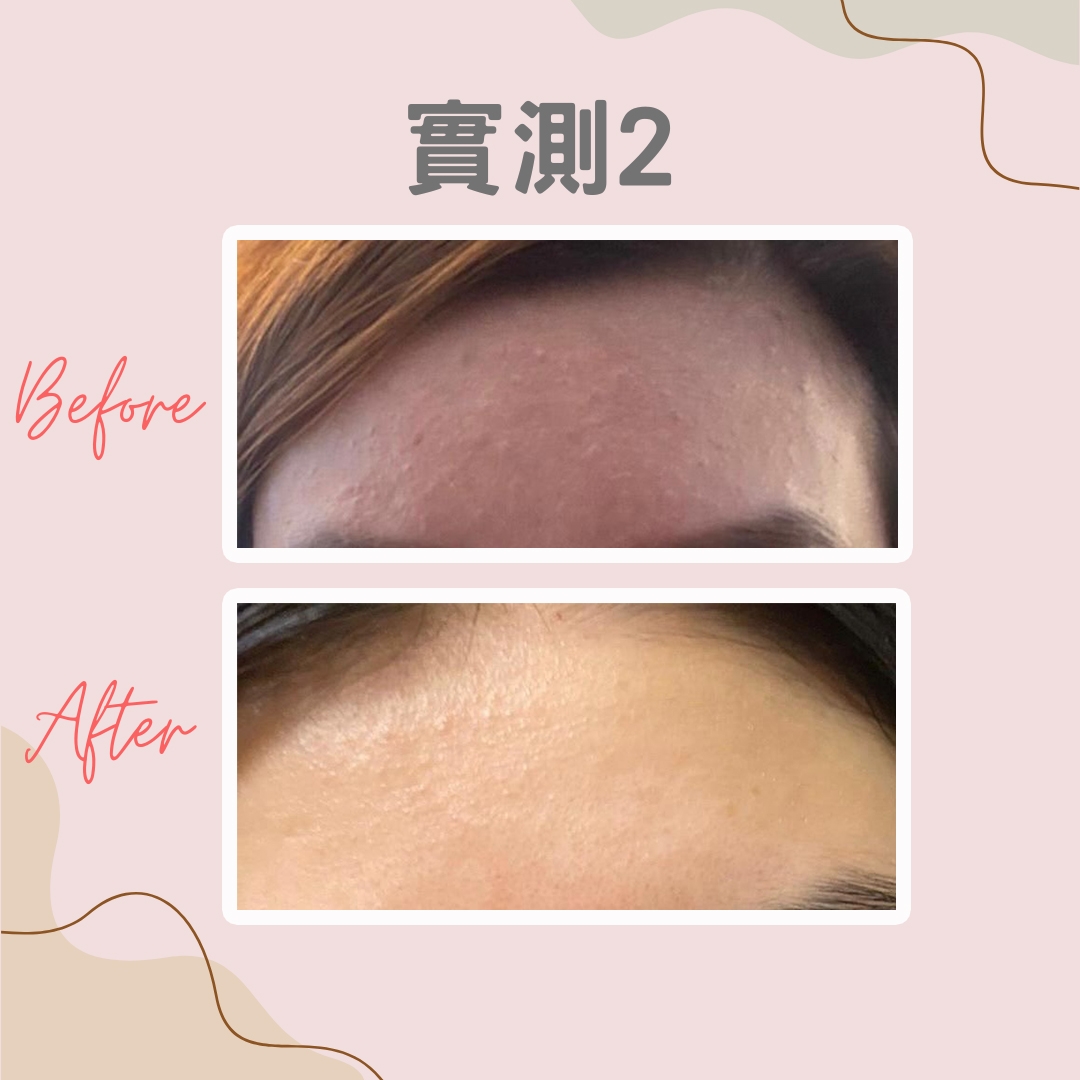 實測2：明顯美白＋退紅