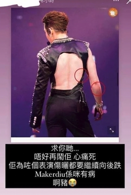 Anson Lo在演唱會上亦有受傷
