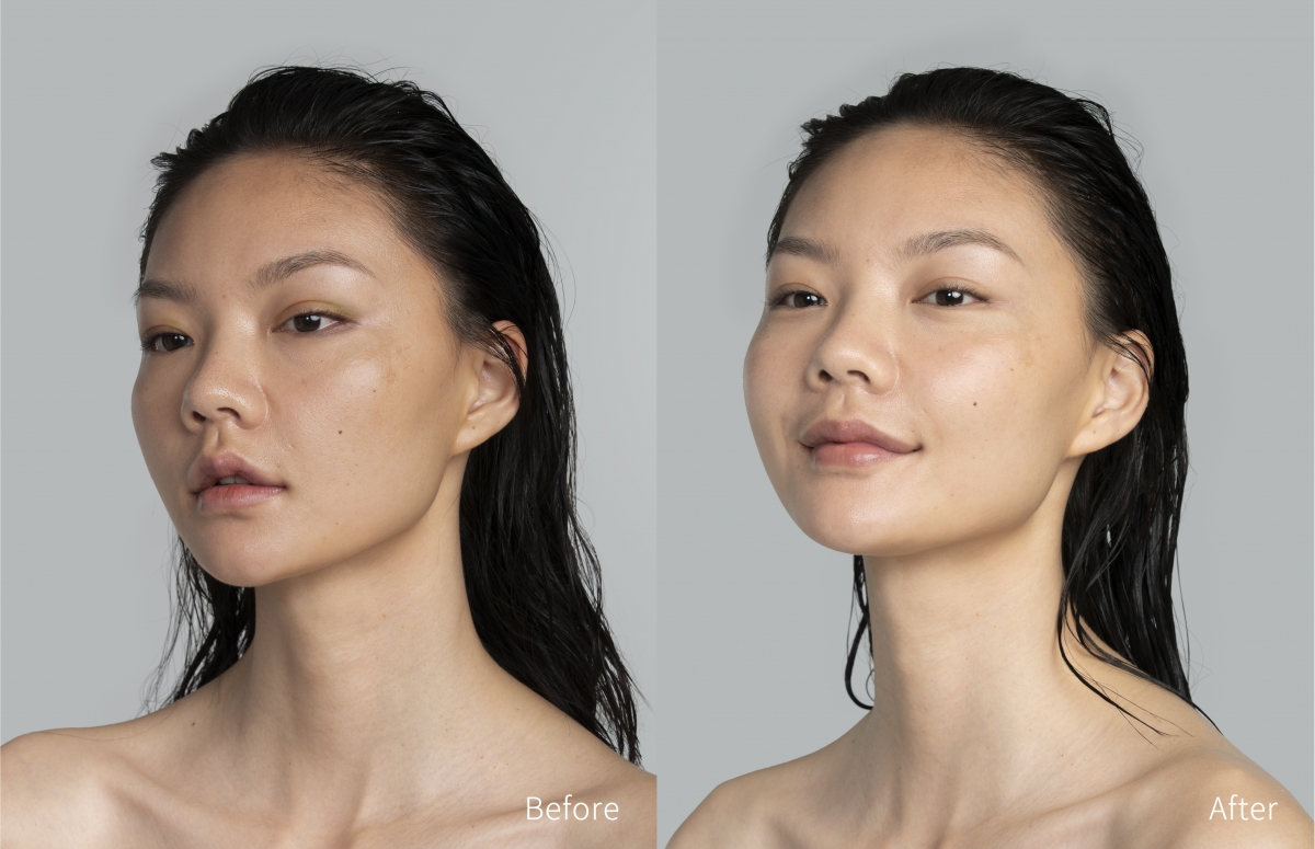 用LUNA™ 3潔臉後,肌膚明顯地變得有光澤,膚質亦變得細緻柔滑。
