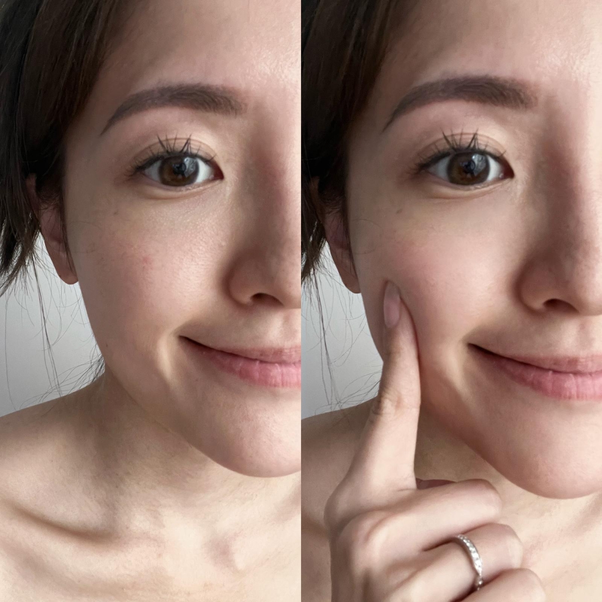 KOL Edith表示皮膚明顯更有彈性及緊緻~