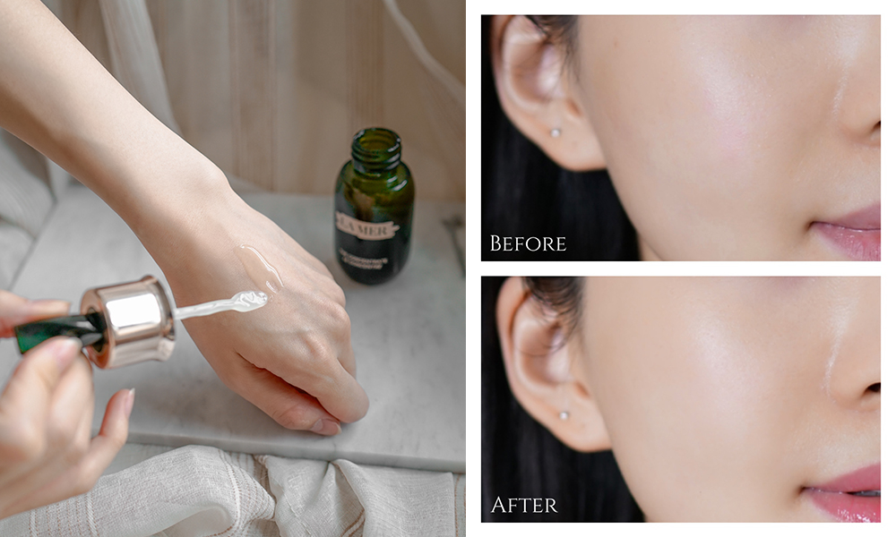 Aiko 大讚用完 La Mer The Concentrate 幾日，舒緩炎症及敏感效果好驚喜，就連皮膚更亮白及細緻。