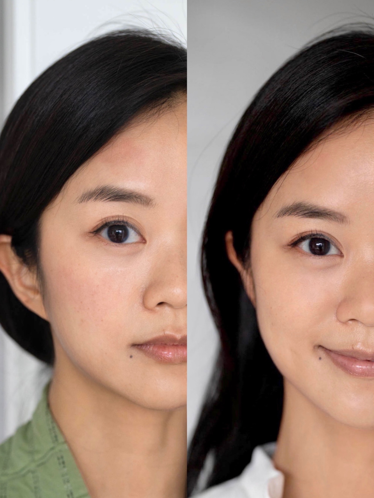 只用了短短 2 天，Janet 的肌膚已迅速回復健康狀態。