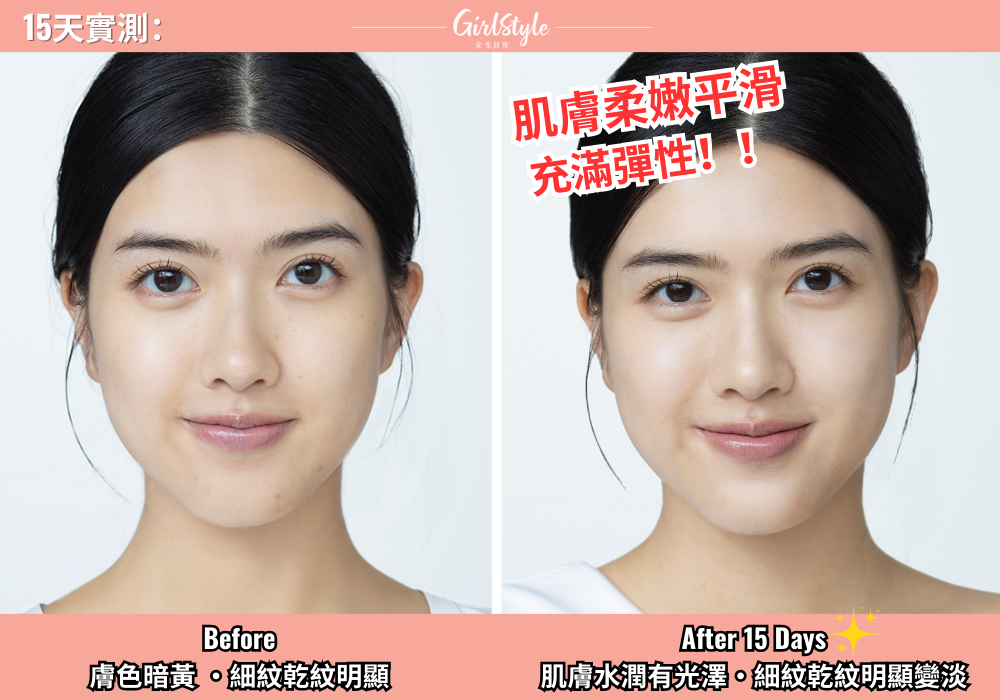 15天實測L'OREAL PARiS新升級玻色因PRO^鮮注面膜淡紋實力!