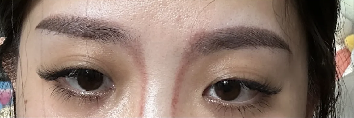 大陸女$1.5萬紋眉紋鼻影效果崩壞險毀容