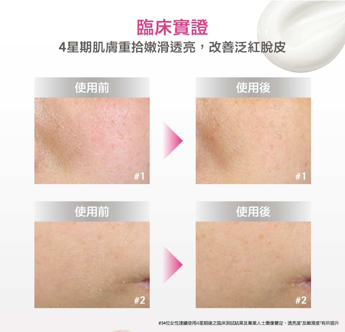 100%³用家一致認同,即時鎮靜泛紅及痕癢狀況相當到位。