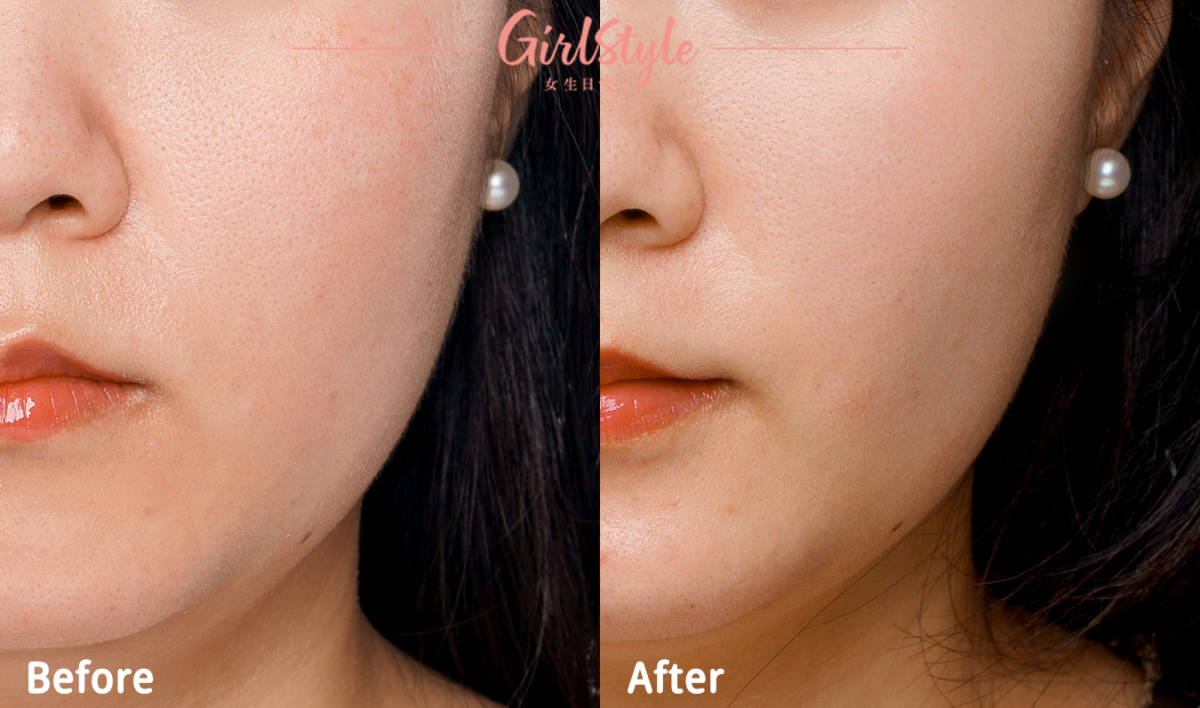 Queenie表示使用後肌膚繃緊完美解決，就連毛孔都收細了，超驚喜！