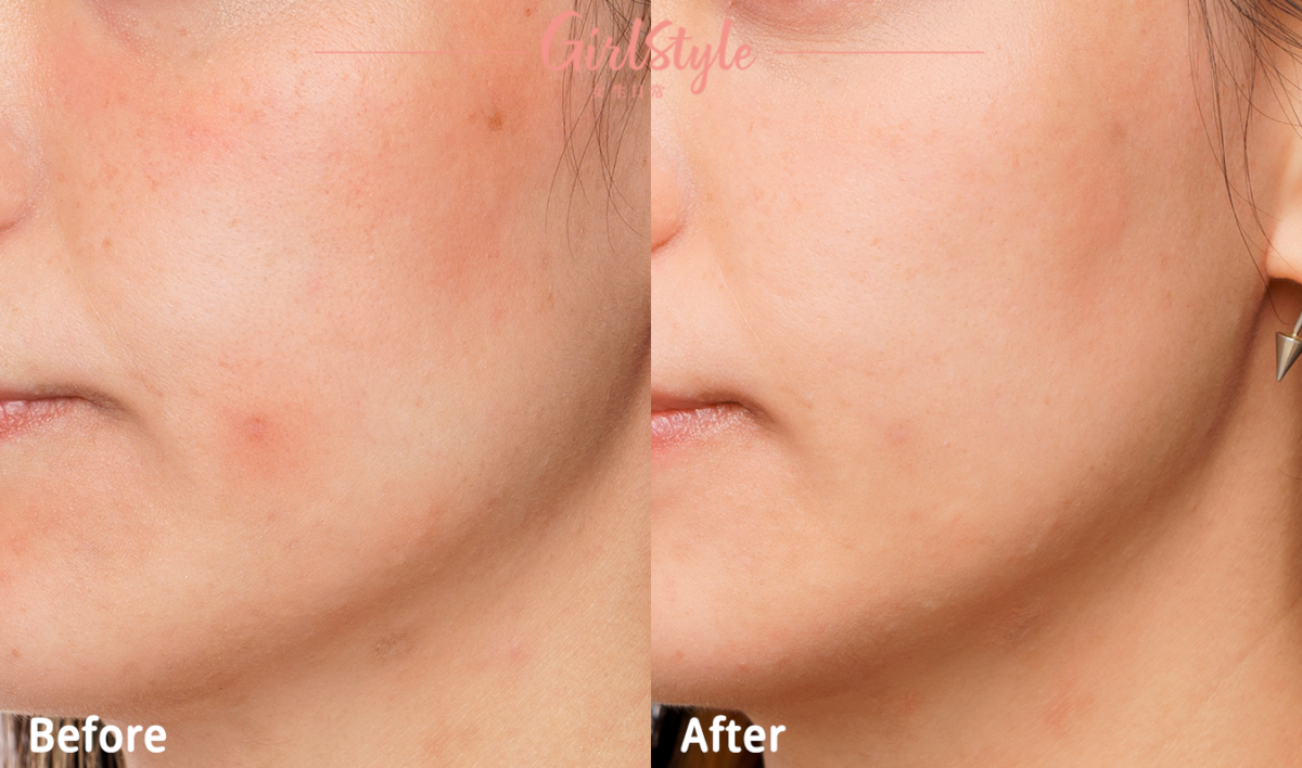 一年四季受乾燥肌影響的Yumi，用後即時感到肌膚屏障有改善，12小時都仍然水潤！