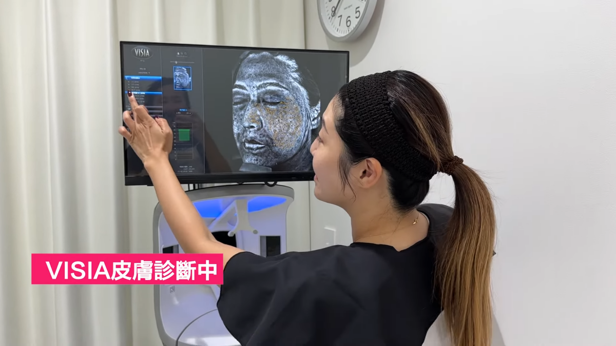 使用前，熱菇的毛孔粗大、細紋、色斑問題比較明顯。