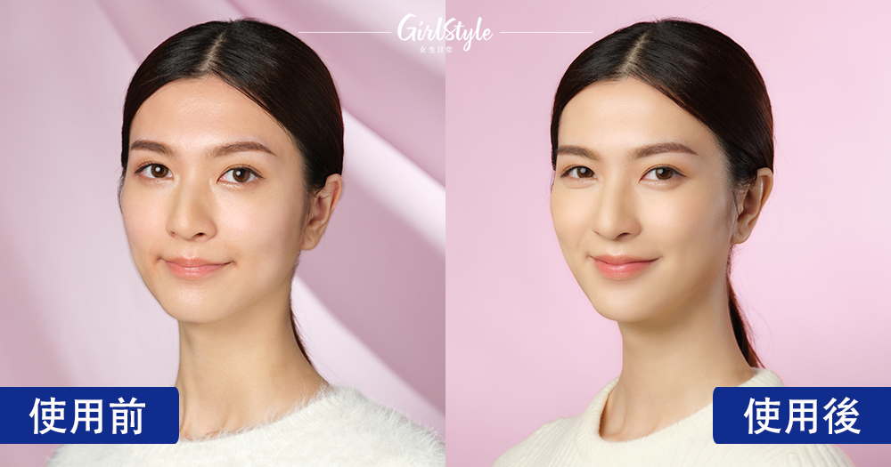 美編使用前及使用2星期後的分別，可見蘋果肌明顯提升，輪廓清晰可見。