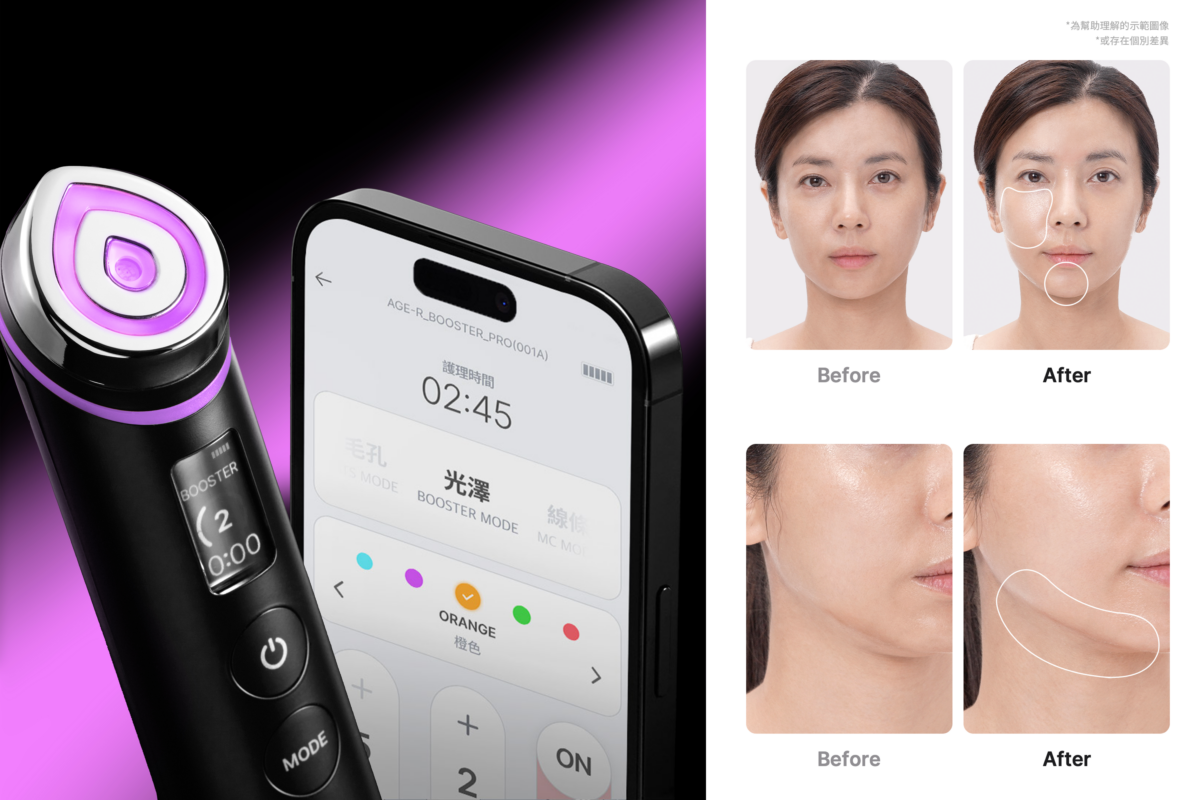 下載AGE-R APP啟用5種LED及聲波震動功能，按照自己的肌膚煩惱選擇不同LED功能。