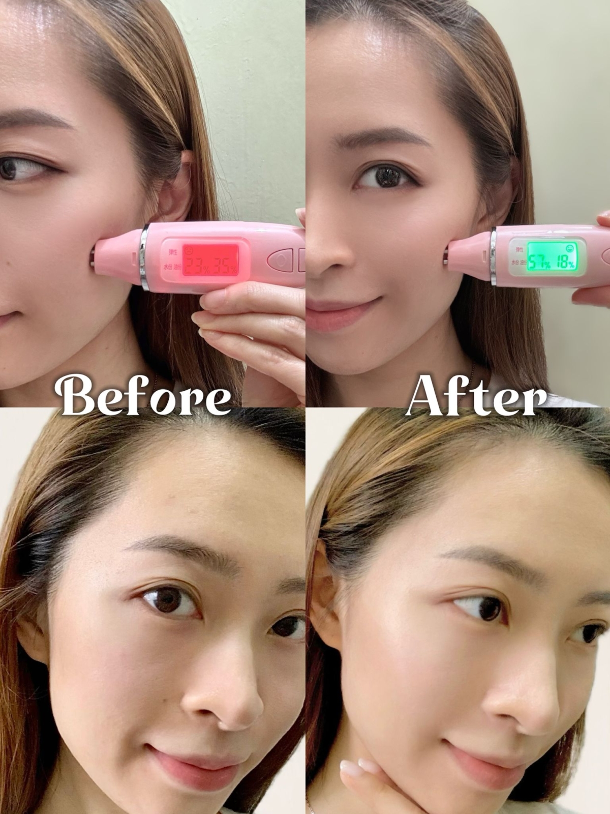 用家Yolanda使用fresh紅茶精華水的前後對比