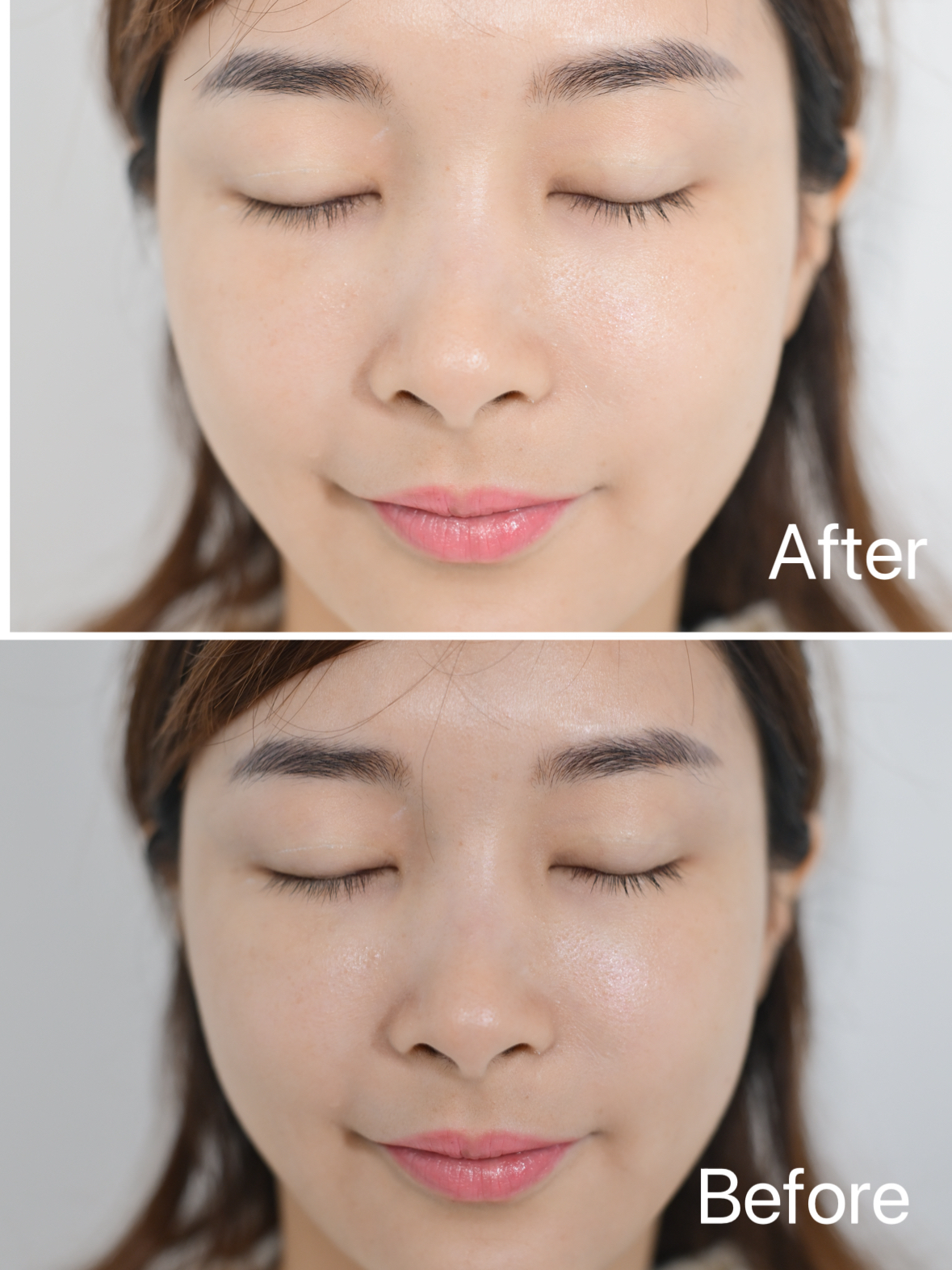 用家南南使用fresh紅茶精華水的前後對比