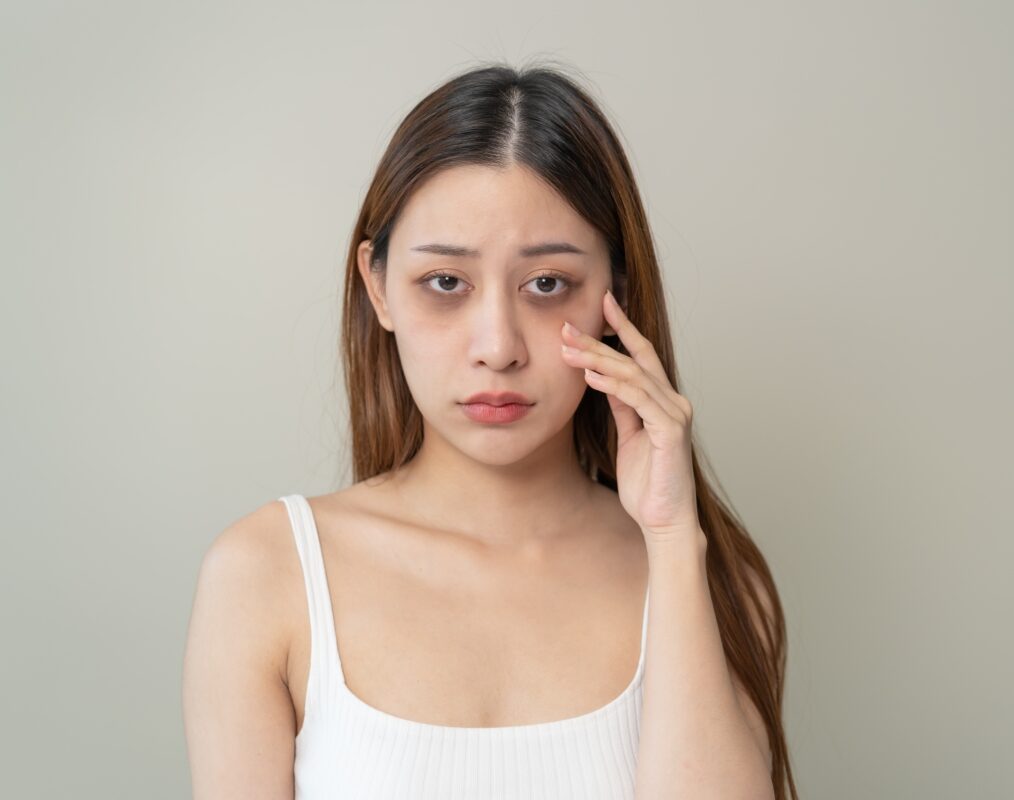 市場上有很多睫毛增長液都會導致黑眼圈問題。