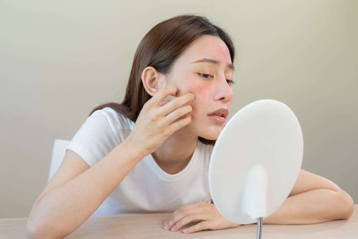 皮膚敏感(或皮膚過敏)通常源自免疫系統對特定物質的過度反應。