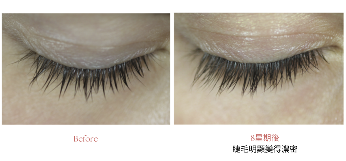 TALIKA Lipocils Platinium「極致晝夜睫毛滋潤液」填滿睫毛空隙,超有感變濃密!
