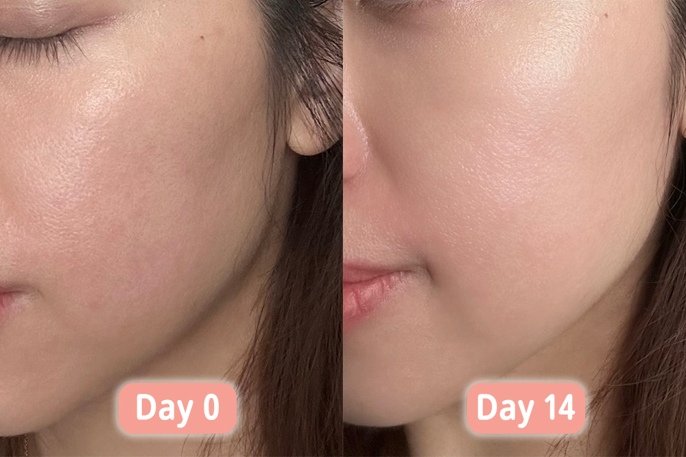 真實用家vvkurashi試用OLAY水小白瓶²及零感防曬⁵前後的膚況。