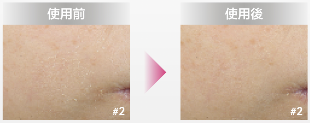 臨床實證，4星期肌膚重拾嫩滑透亮，改善泛紅脫皮。