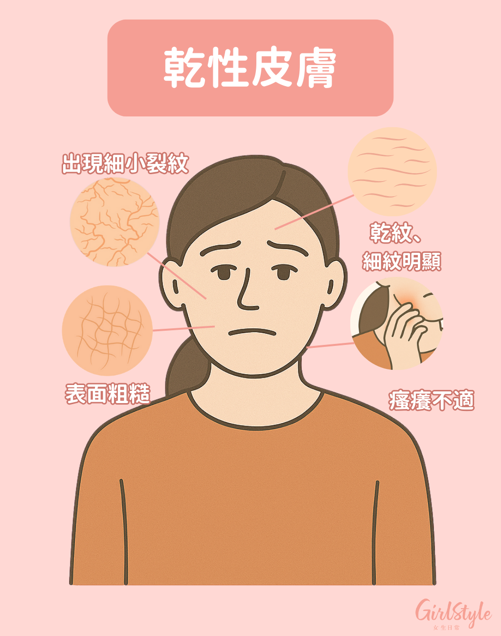 乾性肌膚會出現細紋、瘙癢、表面粗糙的症狀