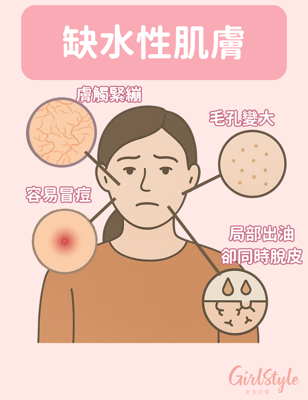 缺水肌會出現外油內乾的症狀