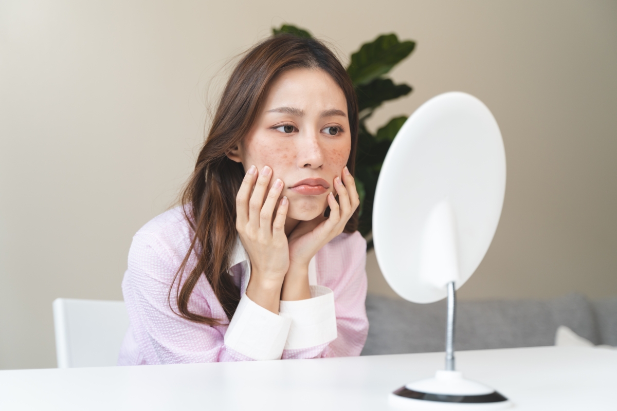 有些人會形容臉上出現「皮膚一點一點黑黑的」小斑點，這通常是指零星分佈的黑色素沉澱現象。