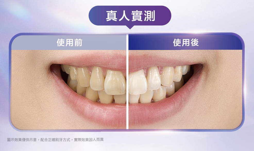 真人實測!Before & After太明顯,超吸引!