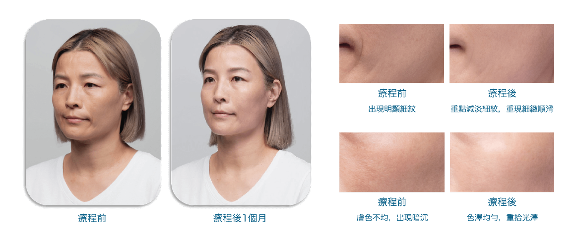 身為精緻女生都會愛上的 #水光界愛馬仕！讓肌膚好到發光～