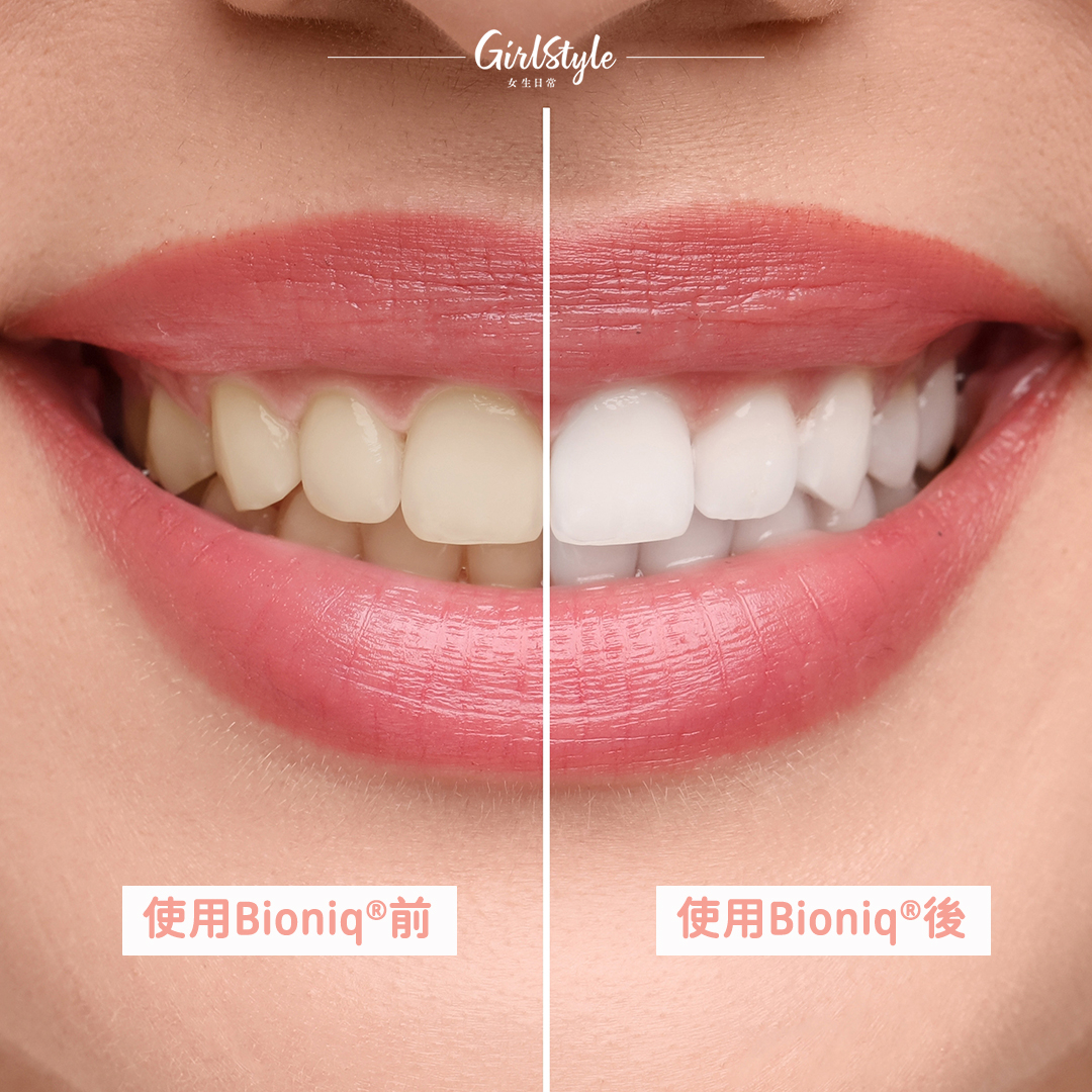 美編親身持續使用了Bioniq®琺瑯補充美白牙膏一段時間，發現牙齒變得越來越光滑，而且肉眼可見地變白了許多！