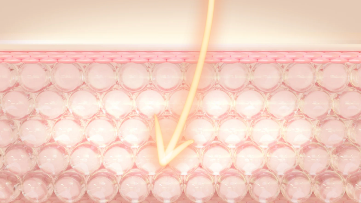 以冷卻+高頻技術深入至脂肪層,並分解脂肪細胞。