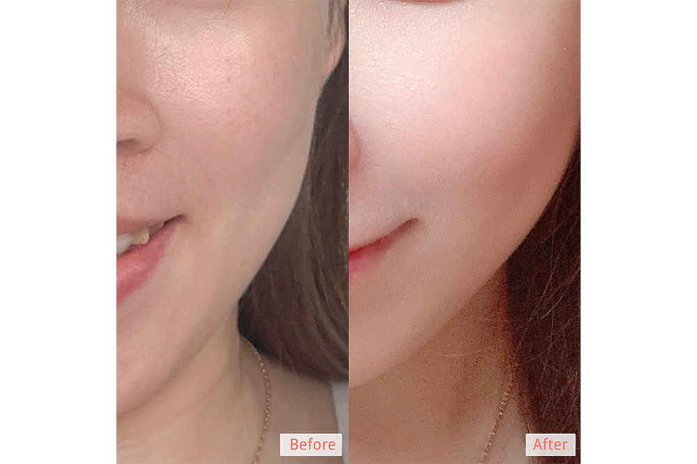 Alice試用Avene精華後肌膚狀態的前後對比