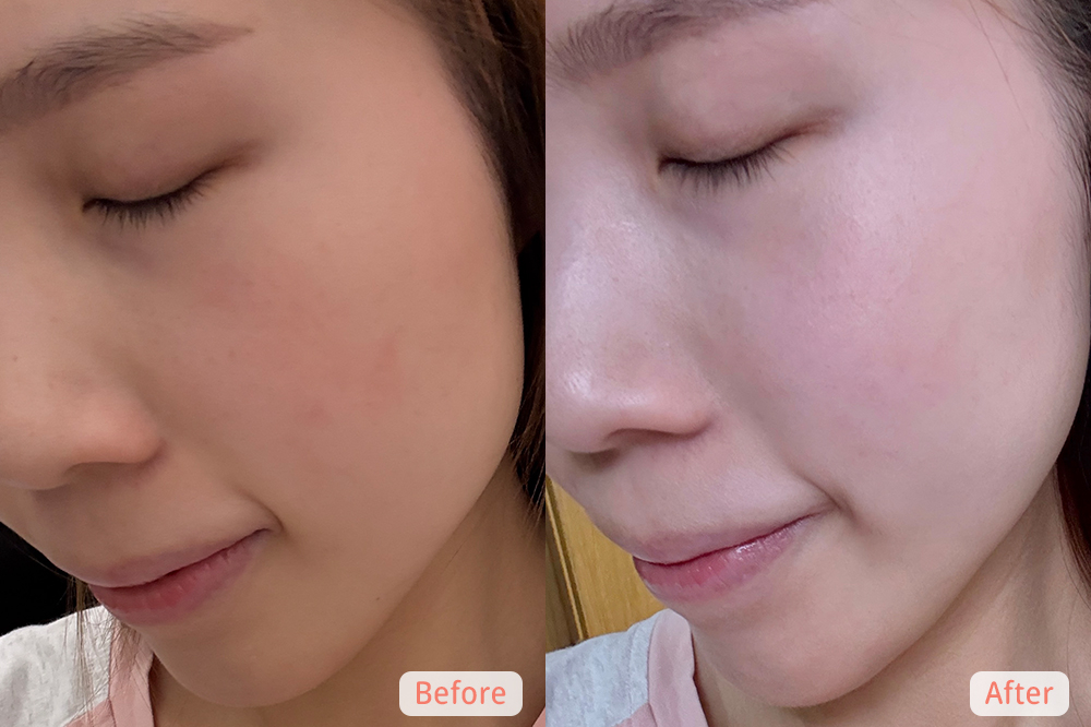 Fionne試用Avene精華後肌膚狀態的前後對比