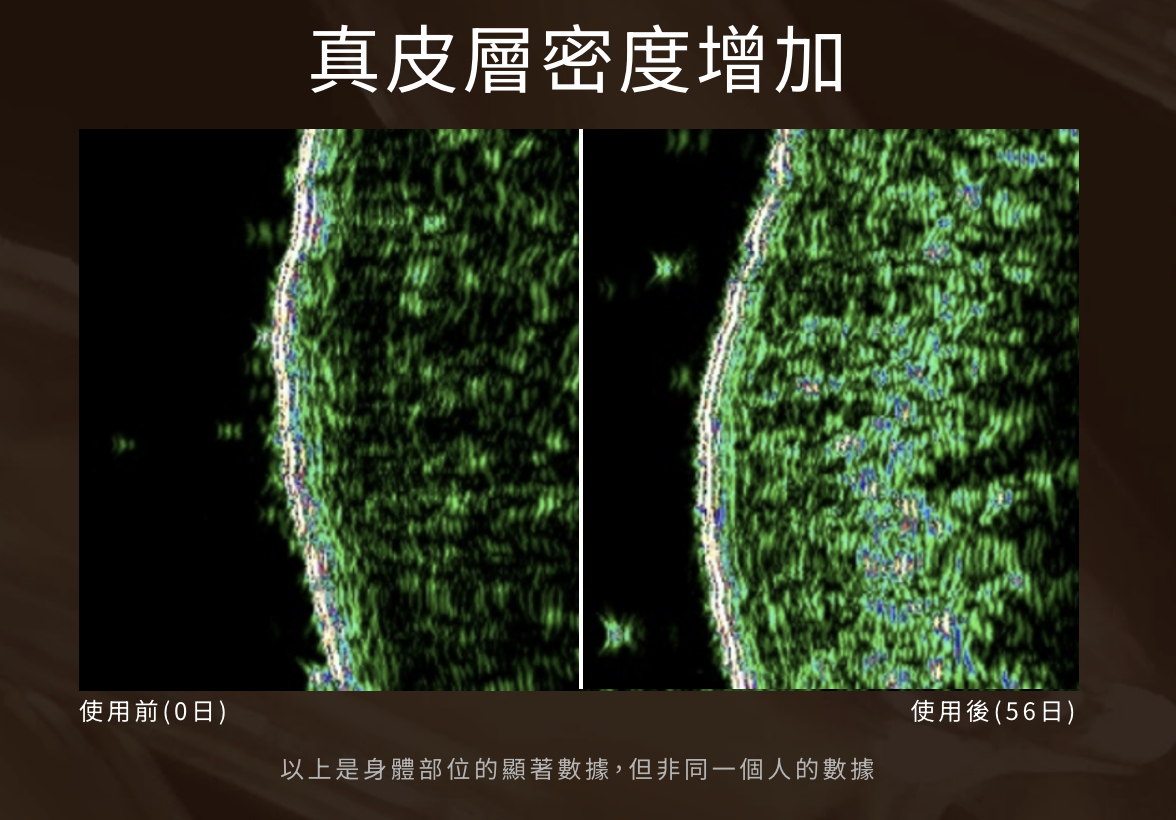年輕緊緻精華能令真皮層密度增加，提升肌膚彈性。