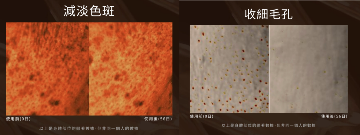 年輕緊緻精華就連能色斑及毛孔都能KO～真是女生人手一支的全能精華！