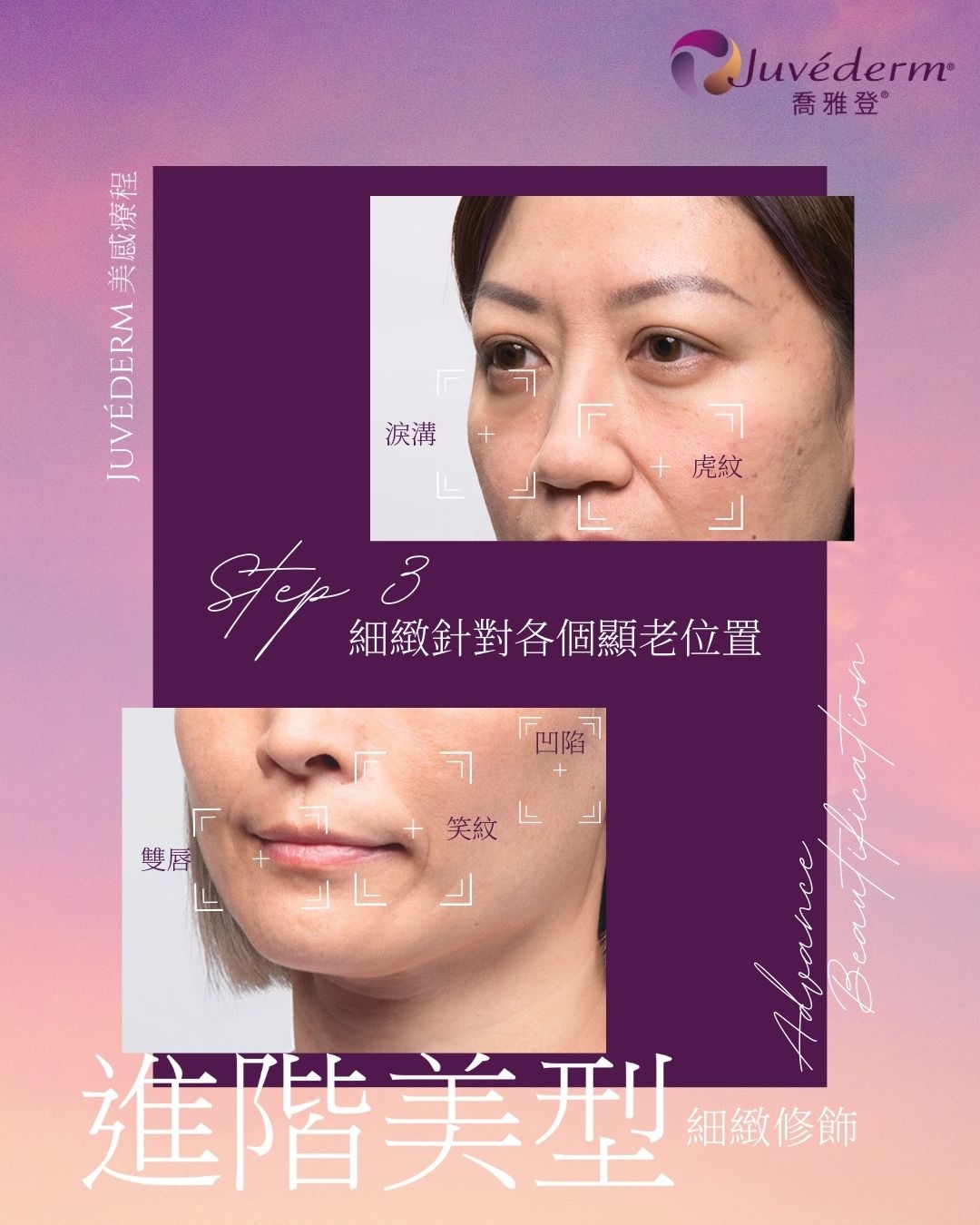 美感第3步：細緻修飾